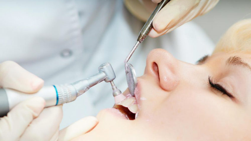 dentist-teeth-cleaning