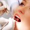 Common Reasons for Tooth Extraction and the Different Methods
